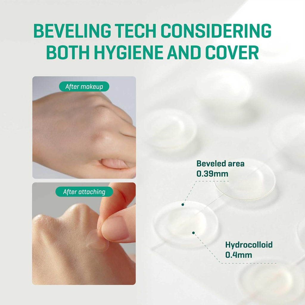 Some By Mi 30 Days Miracle Clear Spot Patch - Pack of 1, 18 Counts