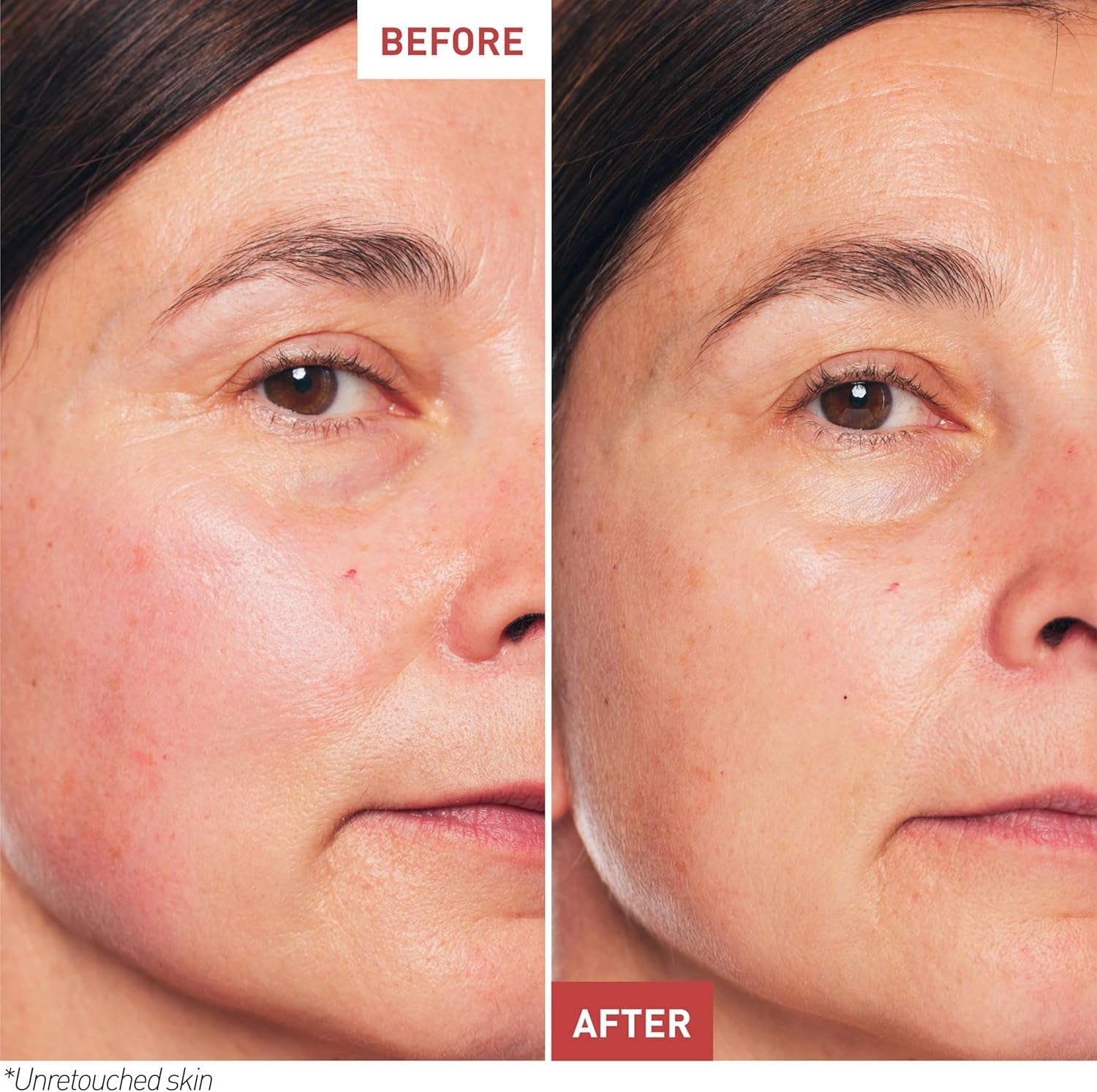 Eborian - Skin Therapy - Multi-Perfecting Night Serum with 17 Super Ingredients