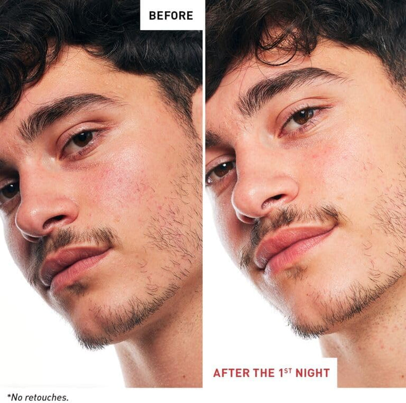 Eborian - Skin Therapy - Multi-Perfecting Night Serum with 17 Super Ingredients