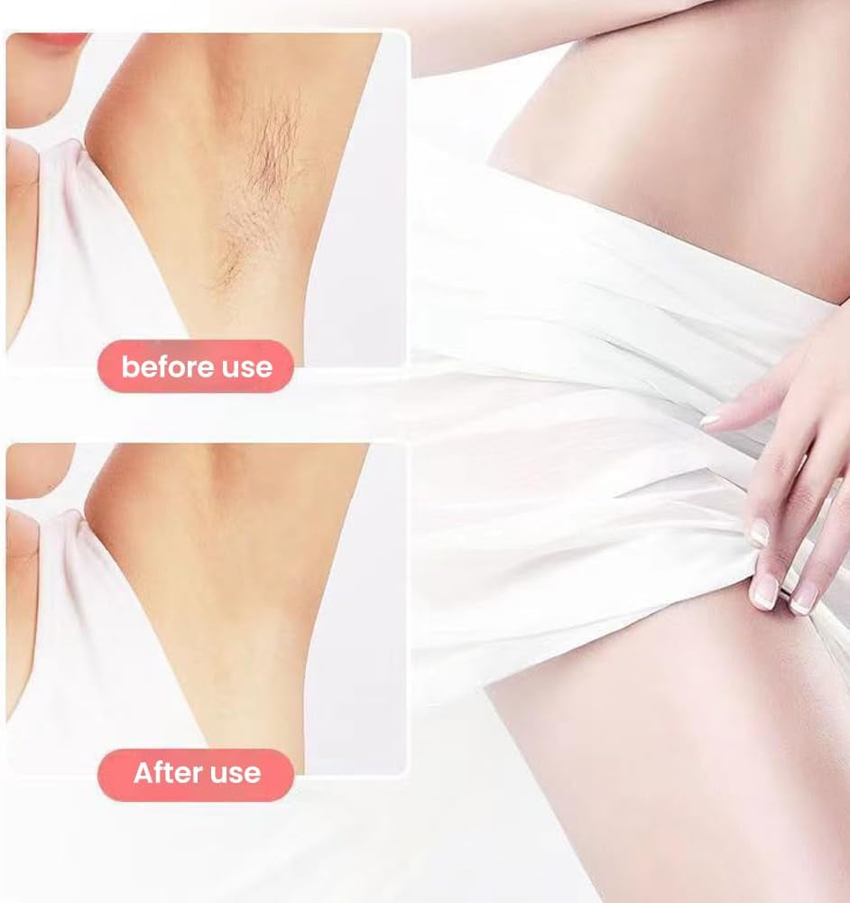 Flawless Rose Gold Facial Hair Remover - USB Rechargeable, Waterproof & Painless with LED Light