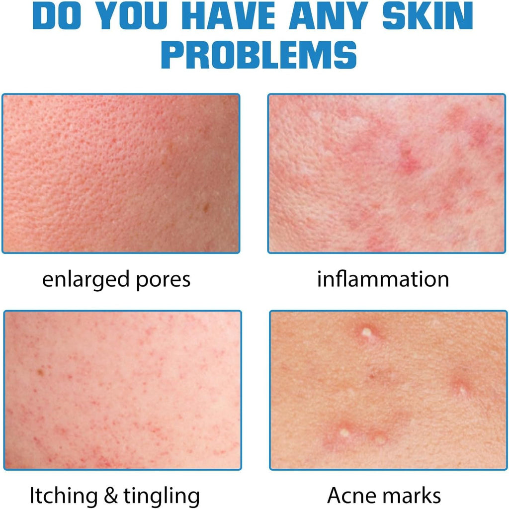 Gla-Mory Ultimate Micro-Infusion Facial & Lip System with Hydrating and Brightening Serums - Anti-Aging Skincare for All Skin Types