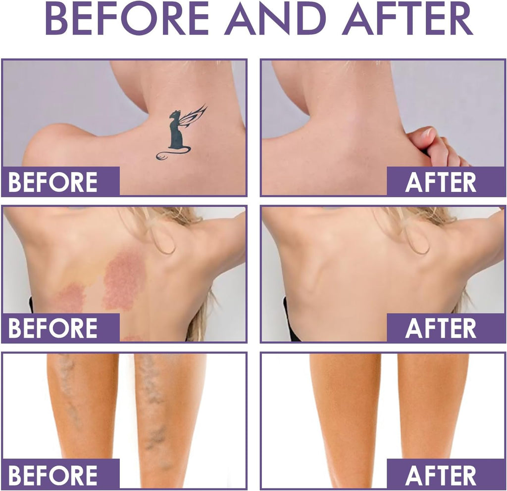 Ultimate Tattoo & Scar Concealer - Waterproof Cover-Up Makeup for Flawless Skin, 74ml