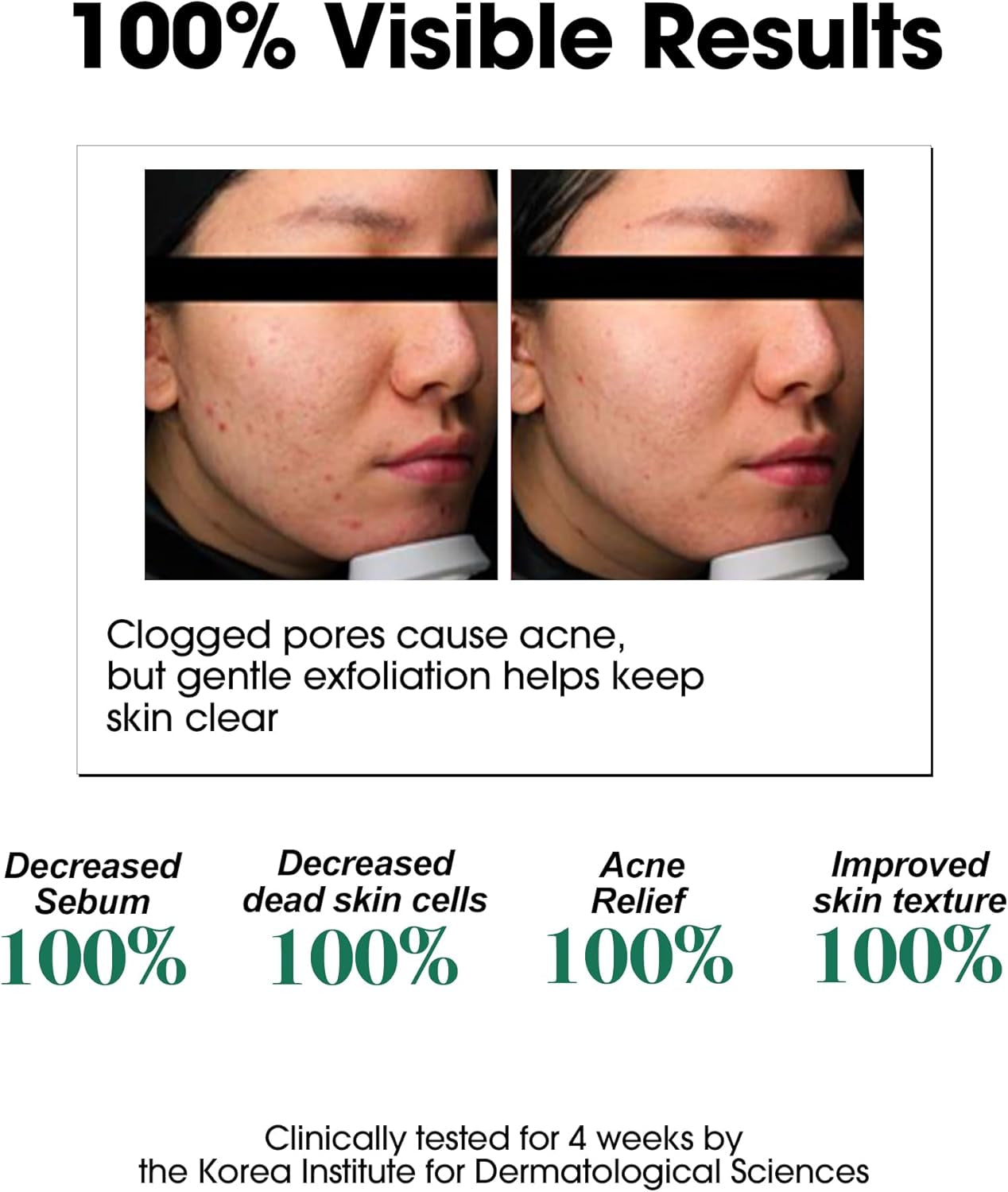 AHA BHA PHA 30 Days Miracle Toner 150Ml