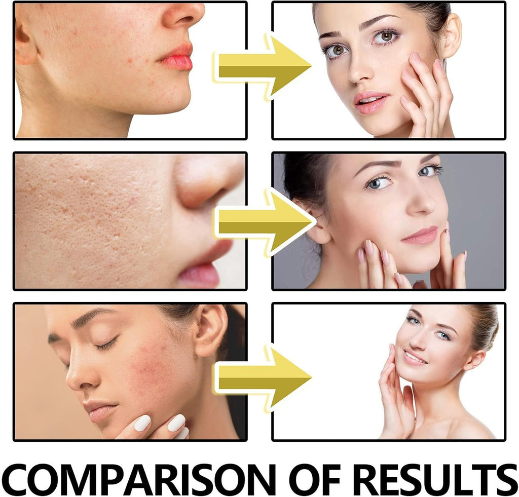 Revitalize Your Skin: 2PCS Bee Venom Anti-Wrinkle Firming Cream for All Skin Types - Multi-Purpose Moisturizer & Age-Defying Treatment