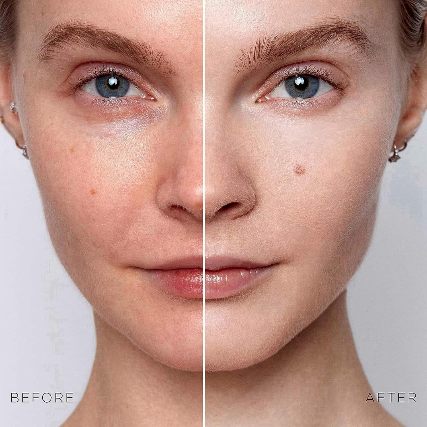 Gla-Mory Ultimate Micro-Infusion Facial & Lip System with Hydrating and Brightening Serums - Anti-Aging Skincare for All Skin Types