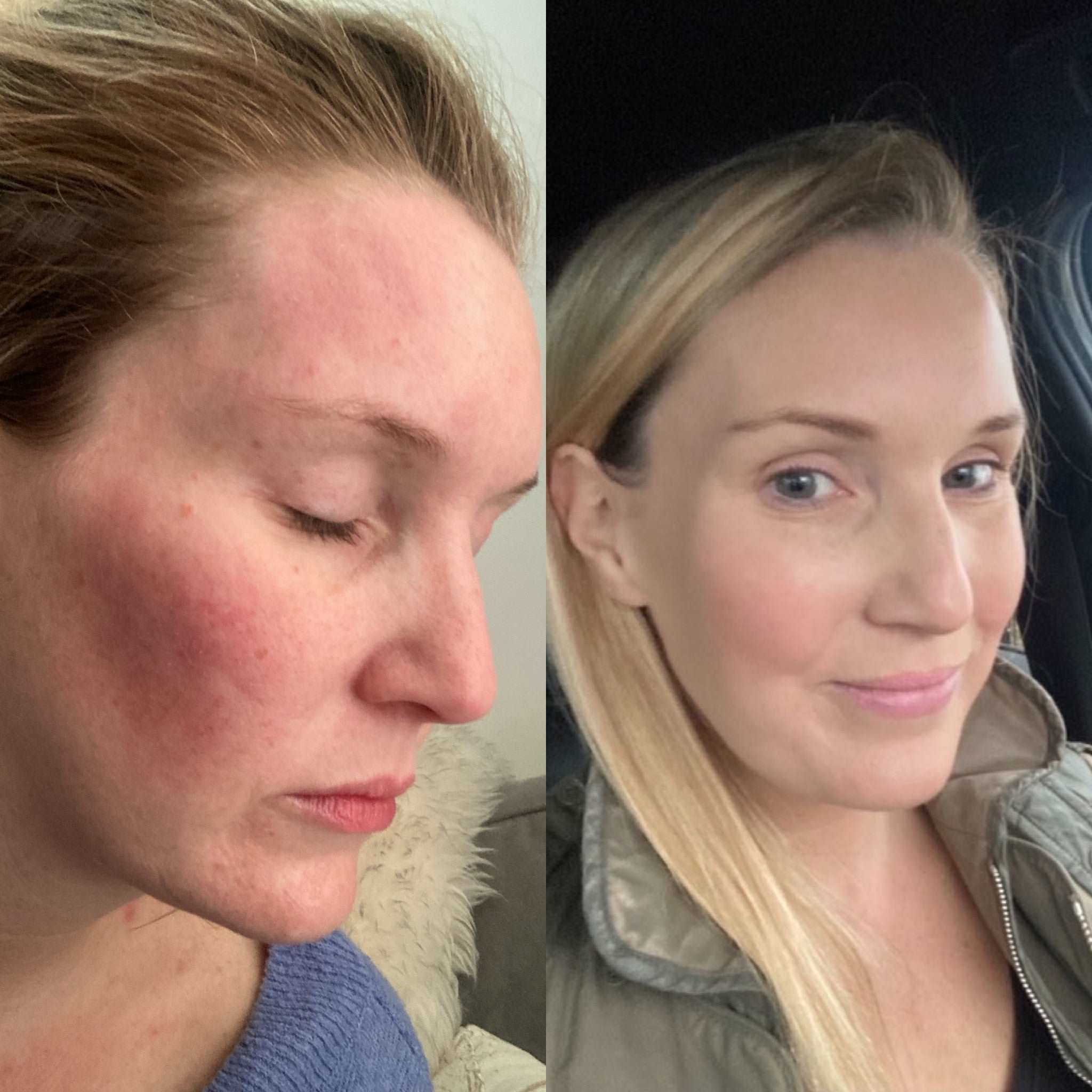 Coconut & Rosehip Calming Moisturiser - 30ml travel/trial size