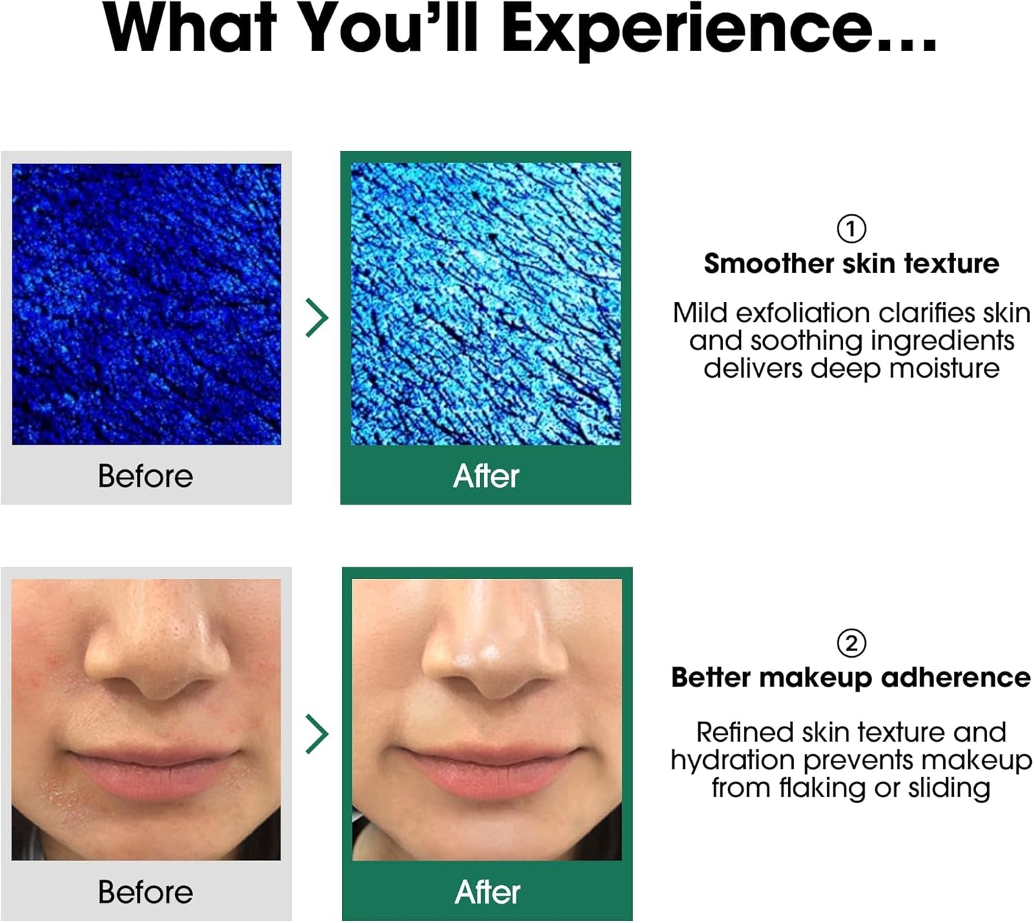 AHA BHA PHA 30 Days Miracle Toner 150Ml