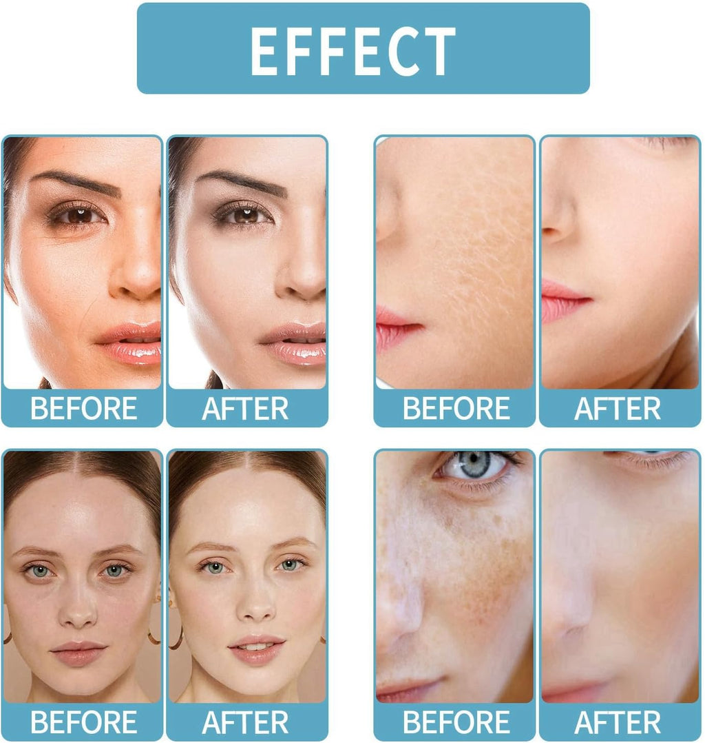 Gla-Mory Ultimate Micro-Infusion Facial & Lip System with Hydrating and Brightening Serums - Anti-Aging Skincare for All Skin Types